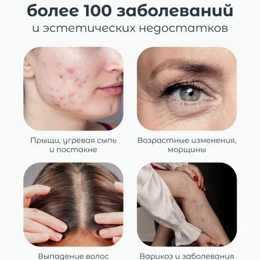 Дарсонваль, идеальное состояние