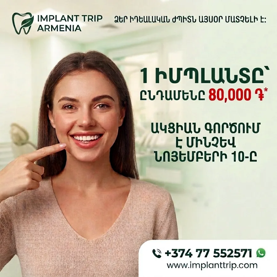 Имплантация зубов, 80 000 драм